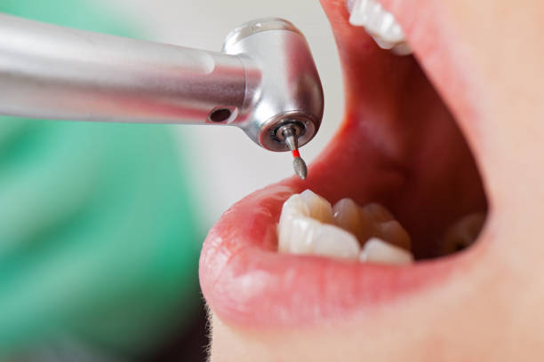Best Knocked-Out Tooth Emergency  in Woodlyn, PA